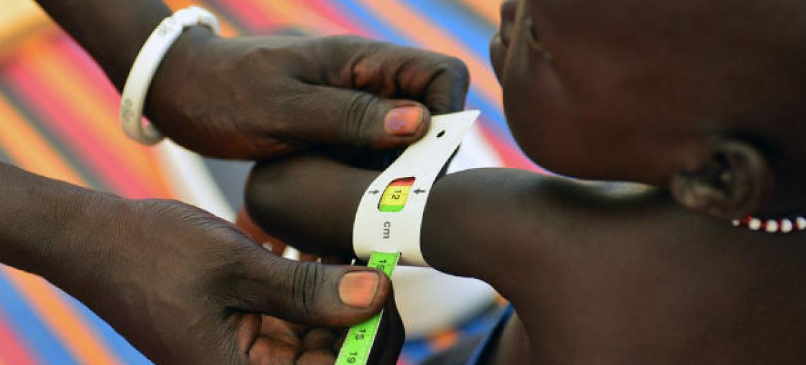 Insegurança alimentar no Sudão do Sul. Foto: Unicef/Christine Nesbitt