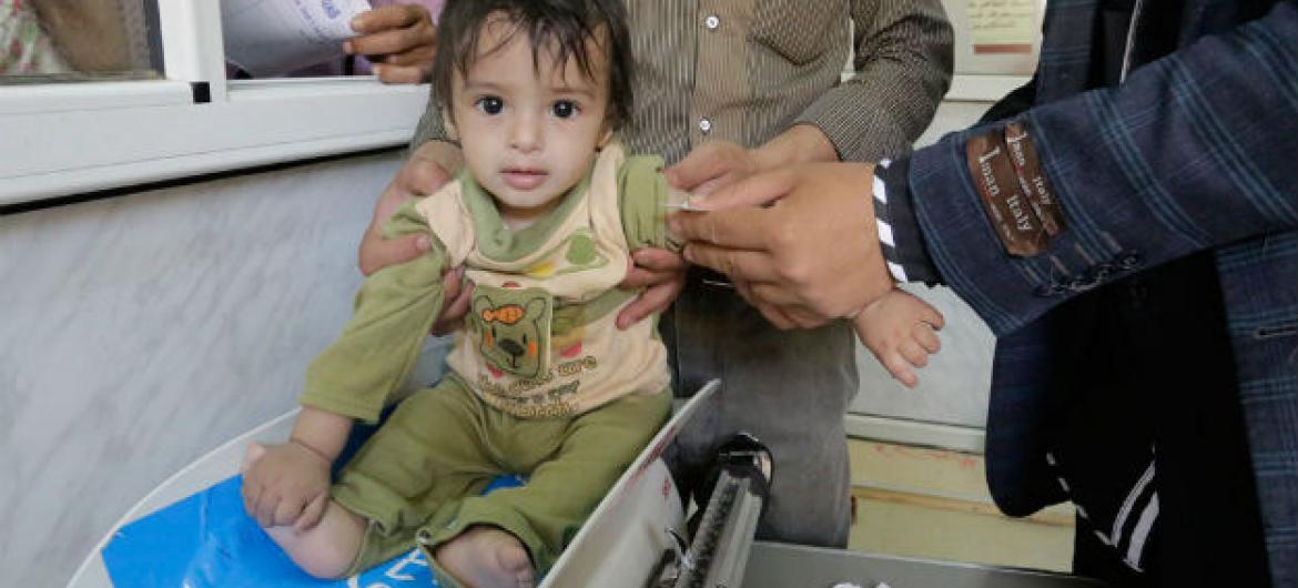 Criança iemnita sendo pesada em um centro de saúde. Foto: Unicef/Ma’ad Al-Zekri