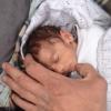 Amira também é chamada de "bebé do cerco". Foto: Rami Al Sayed/Unrwa.org