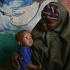 Quase 950 mil crianças menores de cinco anos enfrentarão desnutrição aguda este ano. Foto: Unicef Somália/2015/Rich