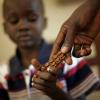 Criança recebe medicamento contra a tuberculose no Sudão do Sul. Foto: Pnud Sudão do Sul/Brian Sokol (arquivo)