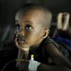 A situação é mais grave na África Subsaariana, que concentra 90% dos casos e 92% das mortes em todo o mundo. As crianças com menos de cinco anos são mais vulneráveis. Foto: ONU/Tobin Jones