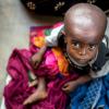 O Unicef aumentou a resposta humanitária com alimentos terapêuticos para milhares de crianças. Foto: Unicef