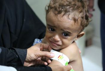 Criança no Iêmen. Foto: PMA/Abeer Etefa