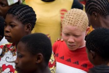 13 июня Международный день распространения знаний об альбинизме. Фото ООН